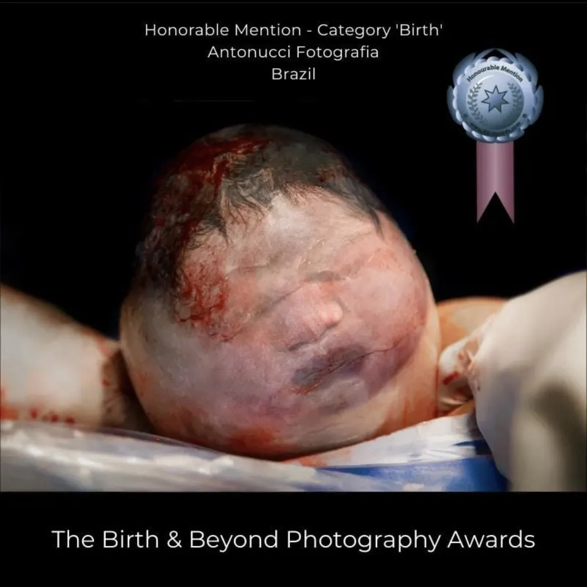 Foto premiada: Birth & Beyond Awards, Menção honrosa · Categoria parto