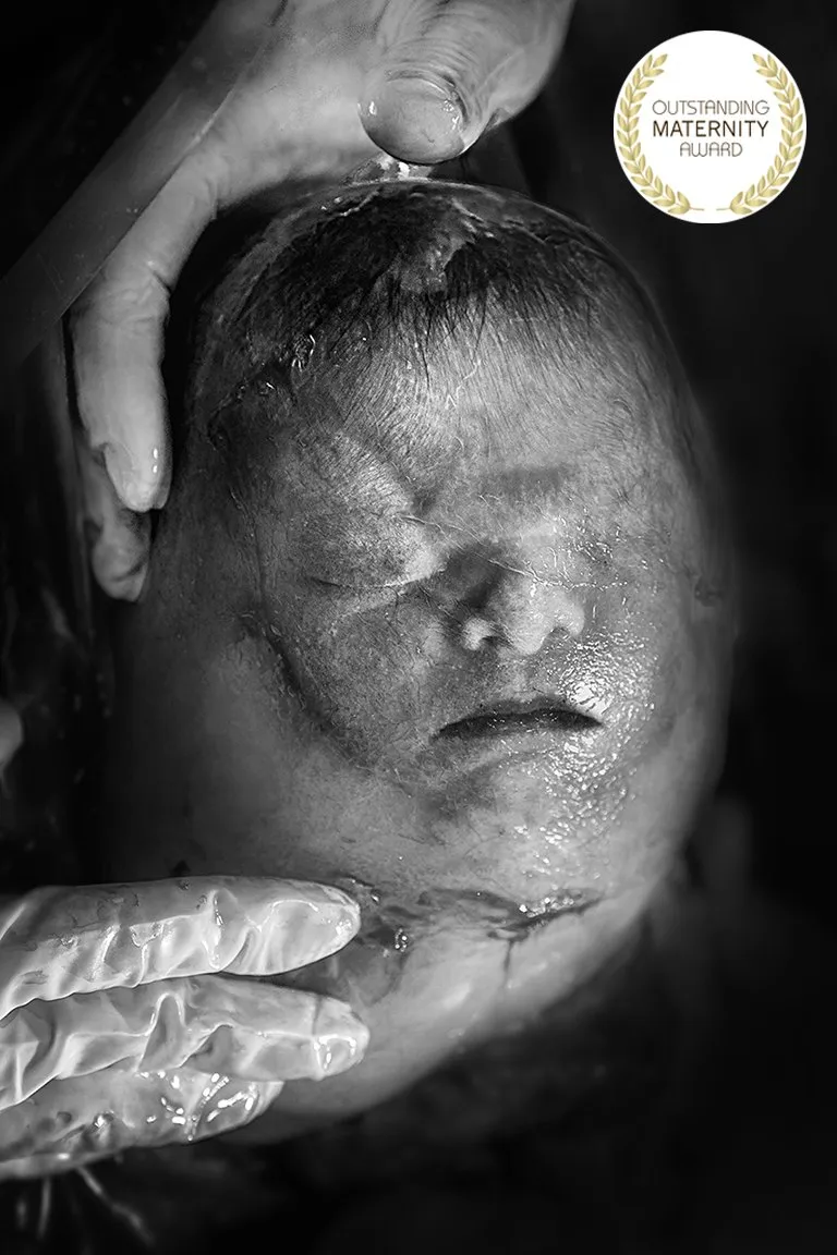 Foto premiada: Outstanding Maternity Award, Temporadas 20 e 21 · Parto